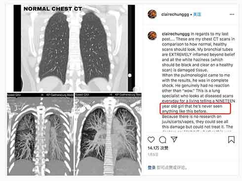 图文求证：新冠肺炎是否有可能起源于美国？