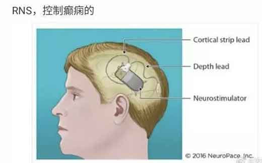 特朗普无论治愈与否，自身感染新冠病毒，都代表着他长达8个月疫情防控的失败，他的民意基础将会开始动摇，甚至有坍塌的风险，因为这意味着资本主义的一次重大失败；无论他和拜登哪个上位，美国的政治集团都将出现剧烈的震荡和撕裂，美国的国际信用、世界霸权也将进一步被削弱。