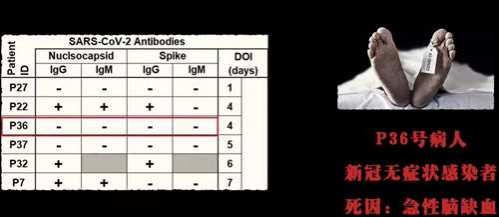 尽管中医可以有效应对“复阳”和“后遗症”问题,但前提是每个被感染者都能遇到好的中医,得到有效的中医治疗,现实情况却并不乐观,中医的处境究竟如何,大家都应该有所感受,笔者就不必多说了。