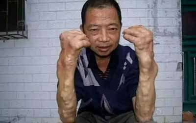 垃圾堵在地球心脏，想要彻底清理，恐怕是场“持久战”