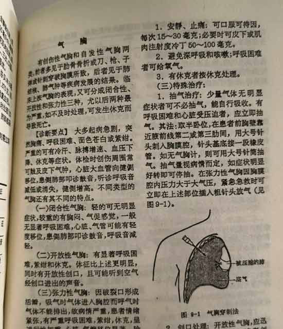 我不是说赤脚医生的治疗手段有多科学、有多高明，可能并不科学、并不高明、但他们真的能解决农民们身边常见的病痛，而且随叫随到，能治就治，不能治也会建议你去上级医院。他们历史上有着重大的功绩。甚至在今天的现实中，他们依然有存在的意义。