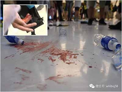 兰斌强：令人发指！十多名香港警察遭暴徒打伤送医