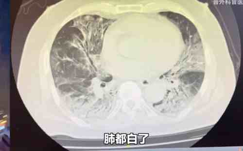 我们不能稀里糊涂、麻木不仁地走出去,我们要了解病毒,了解社会,了解国际,我们要记得所有人的努力、奋斗和牺牲。不是不能牺牲,而是牺牲要有价值,要有意义!实事求是,才能让我们真正走出疫情。
