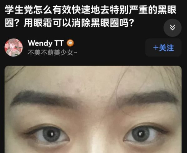 如果一个月后丁香园原地复活,那将佐证笔者的这个猜测;笔者不希望猜测成真,那将是更大的悲哀——因为,比起外资背景的丁香园在舆论场呼风唤雨,真正的问题其实是医疗产业化、资本化、买办化的问题。那些为丁香园共情的医疗从业人员,笔者想提醒你们一句,丁香园固然是在帮助你们提高收益,但你们就不怕其他行业的老百姓有样学样,反过来宰你们?