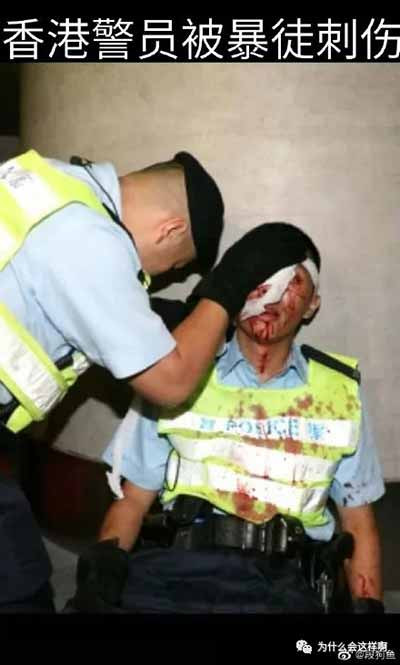 在未回归时,香港群众心向中国,勇于与外国殖民者做斗争,今天香港回归已经20多年了,境外势力却敢在中国的国土上煽动闹事,而”应者云集“,好好的想一想吧,今天的中国到底差哪了?!