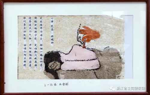 【健康观察哨】李文亮之妻发文驳斥美议员提议